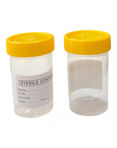 Urine Specimen Container 50 ml 1 piece Urine Specimen Container 50 ml 1 piece